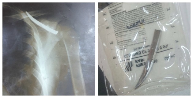 Fotos archivo EL HERALDO