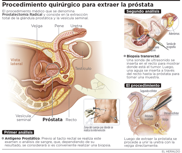 Fotos archivo EL HERALDO