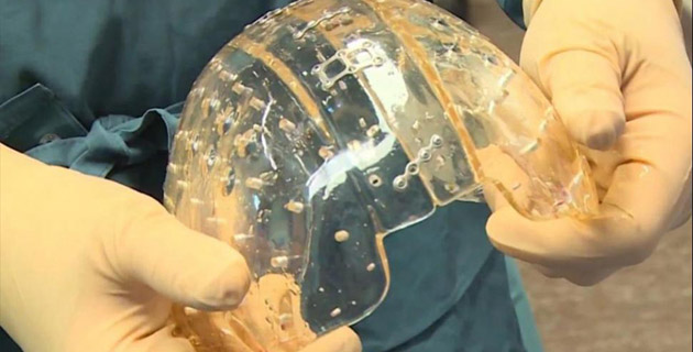 Fotos archivo EL HERALDO