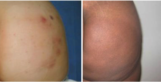 Fotos archivo EL HERALDO