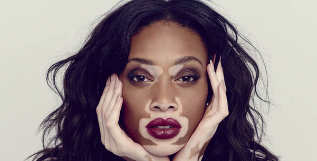 Fotos archivo EL HERALDO