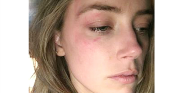 Fotos archivo EL HERALDO