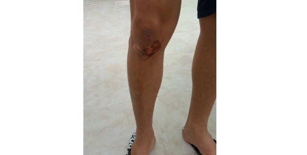 Fotos archivo EL HERALDO